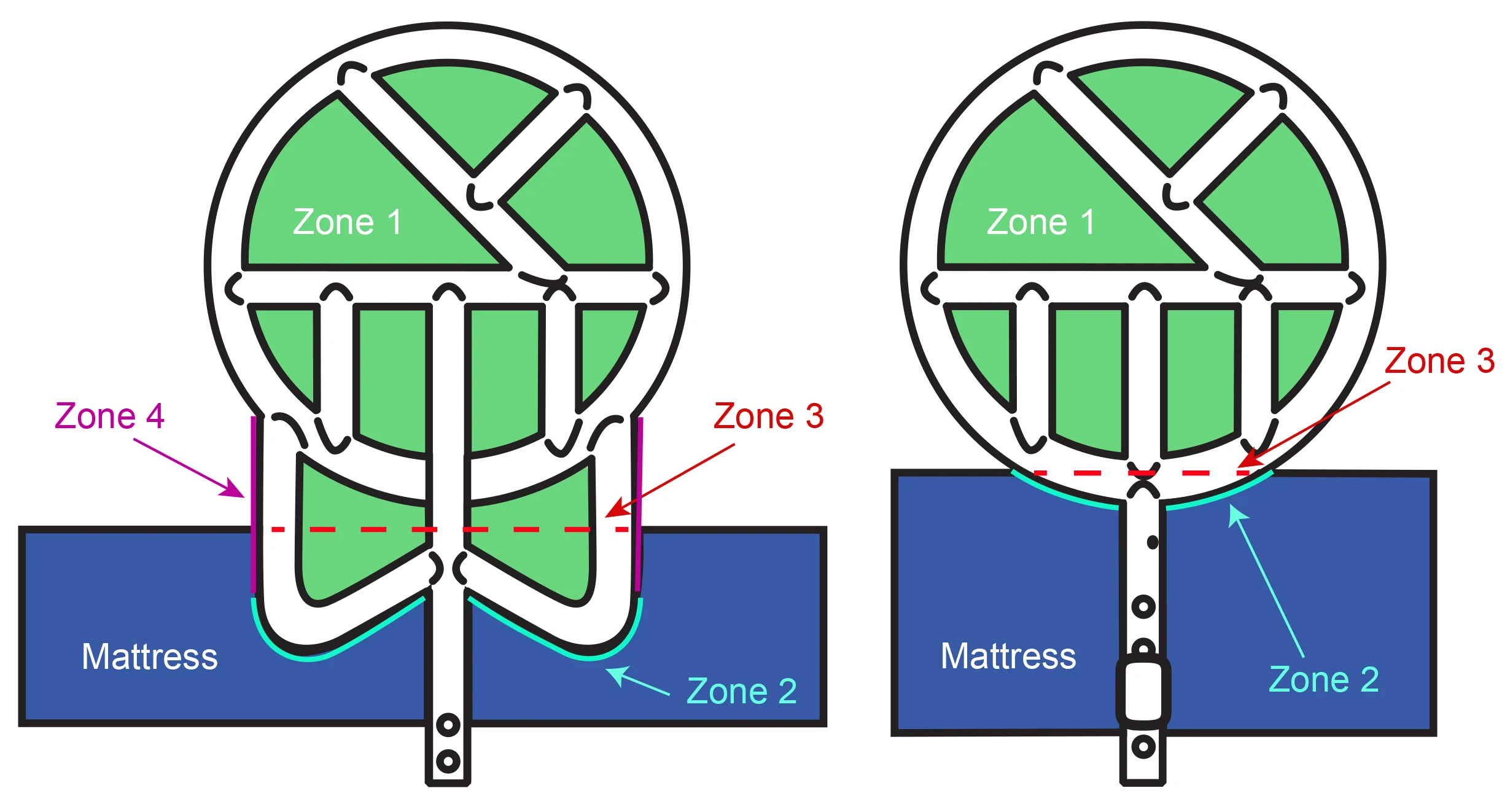 Double Rings Halo Safety Ring Bed Rails Kit For Hospital Beds